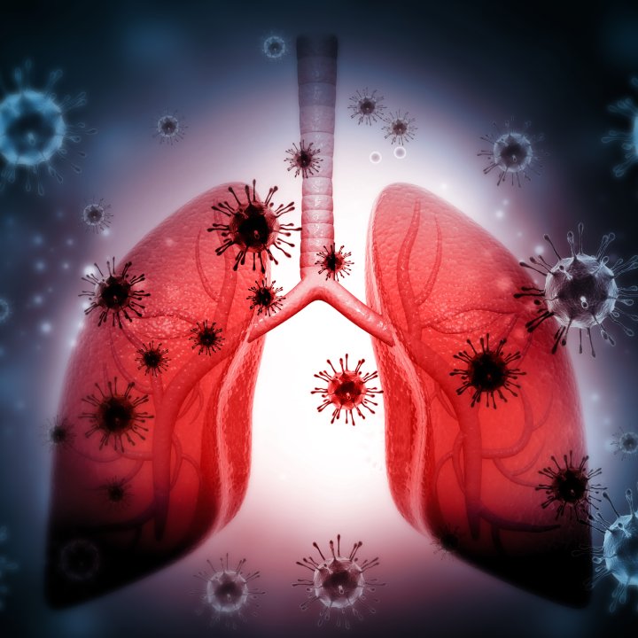 lung infections
