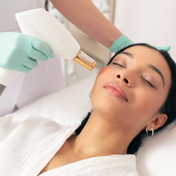 panmed acne pimple laser cure